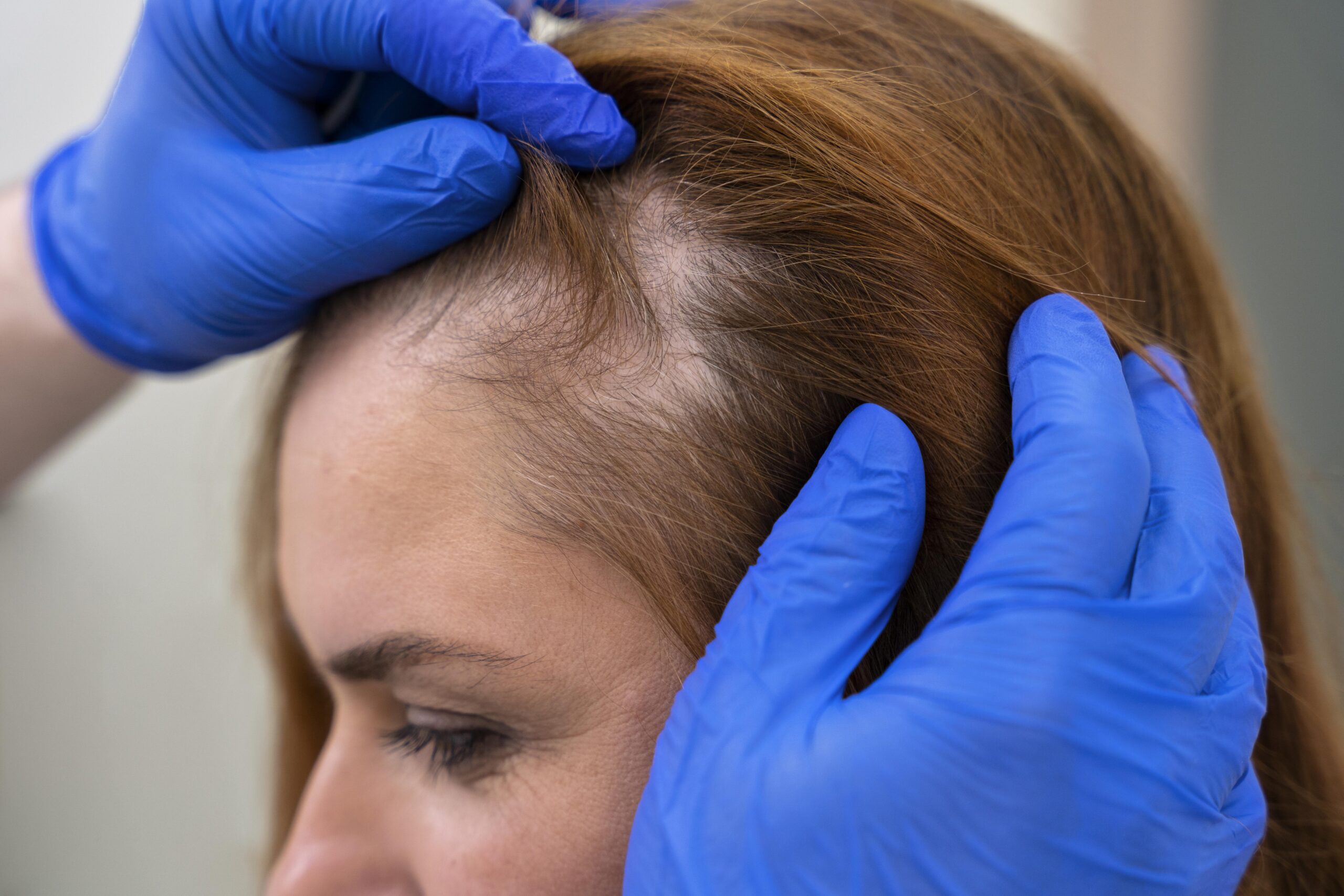 woman-getting-hair-loss-treatment-clinic